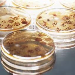 Cover image of Attributing U.S. Campylobacteriosis Cases to Food Sources, Season, and Temperature